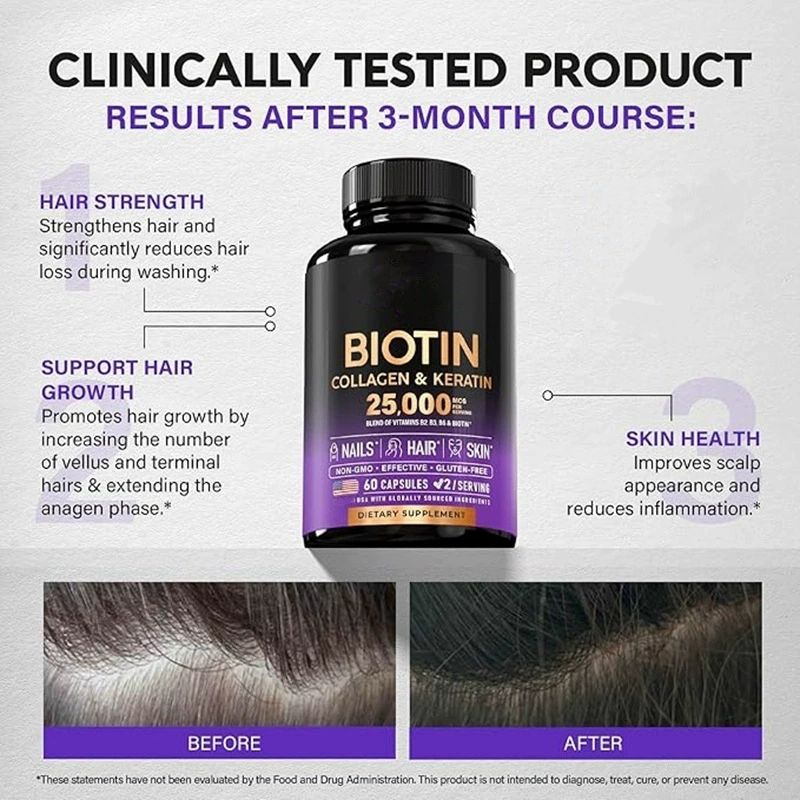25000 MCG Biotin Capsules with Collagen & Keratin, Vitamin B2 B3 B6 Complex for Hair Skin & Nails, Non-GMO Gluten Free Clinically Tested 60 Capsules